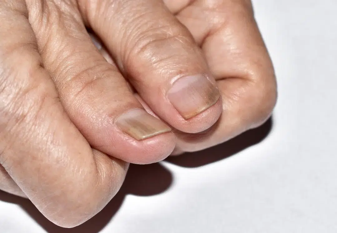 why nails change colour.