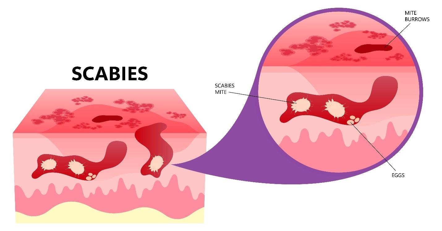 environmental factors contributing to paediatric skin infections.