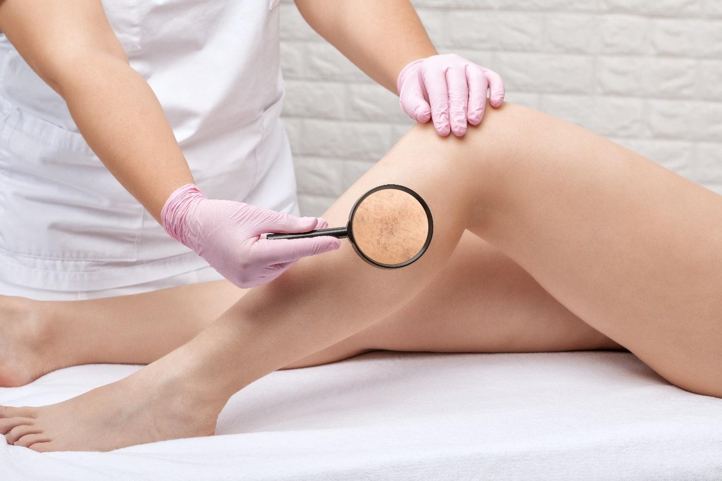 early assessment for facial redness and vascular laser treatment.