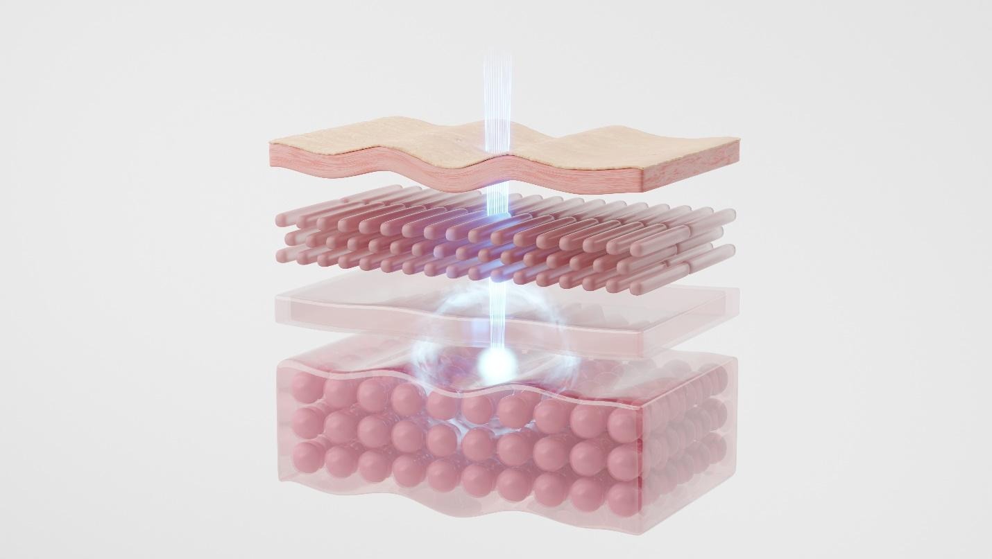 skin assessment, laser application and aftercare.