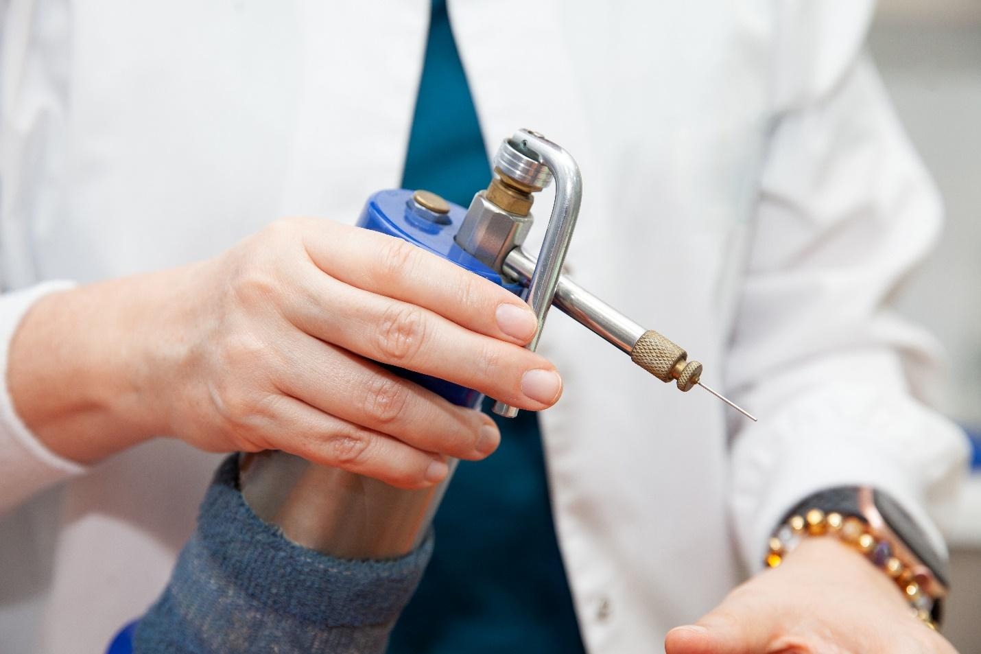 cryotherapy in dermatology for skin lesion treatment.